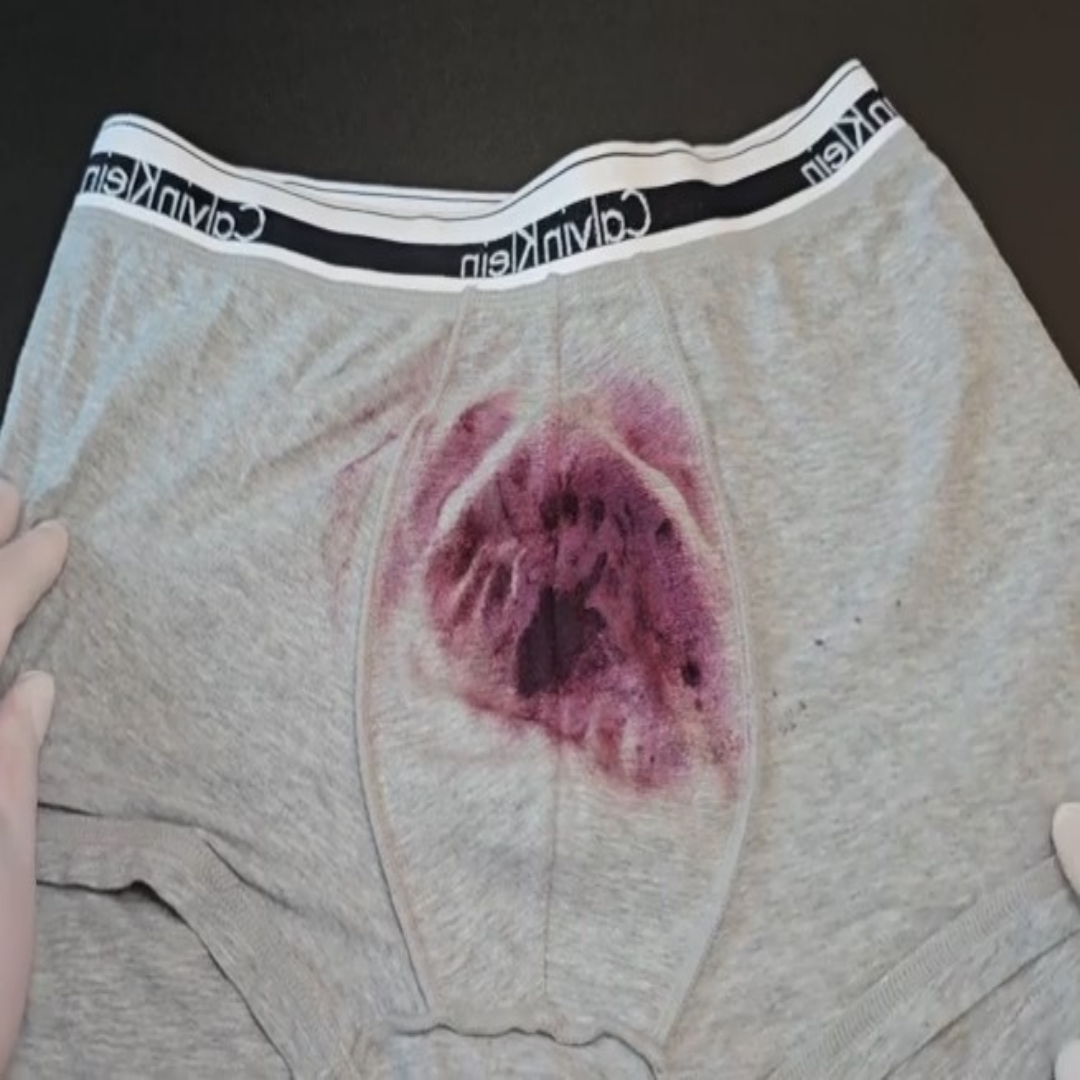 남편 아내 팬티 등 얼룩 분비물 정액 검출 시약 분사식 (스프레이) 14회분 검사