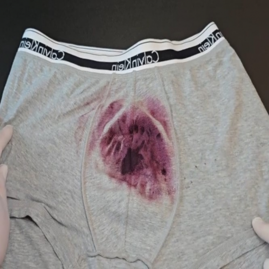 남편 아내 팬티 등 얼룩 분비물 정액 검출 시약 분사식 (스프레이) 6회분 검사